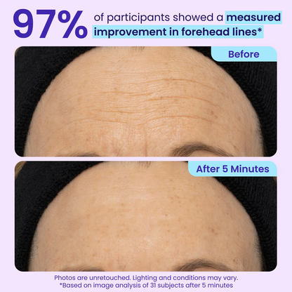 LOVILDS Erase Eye Bags in Minutes — Look Refreshed Instantly